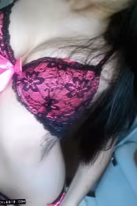 Freckles18 hot photo gallery - picture 1